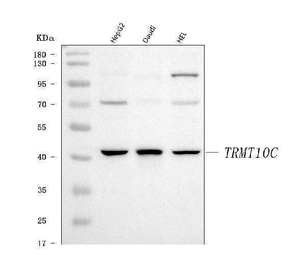 a09612 1 trmt10c primary antibodies wb testing 1
