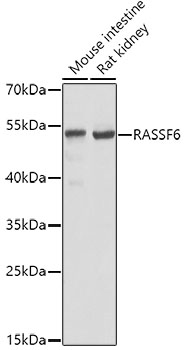 Western blot analysis of extracts of various cell lines, using RASSF6 antibody  at 1:1000 dilution