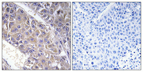 Immunohistochemistry validation of B4GALT3 using Anti-beta-1
