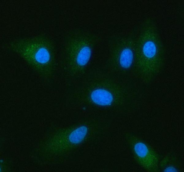 a09619 1 nadk2 primary antibodies if testing 2