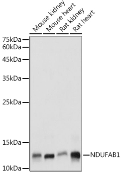 Western blot analysis of extracts of various cell lines, using NDUFAB1  antibody  at 1:1000 dilution