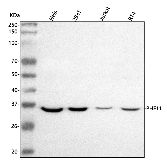  Western blot analysis of PHF11 using anti-PHF11 antibody (A09621-1)
