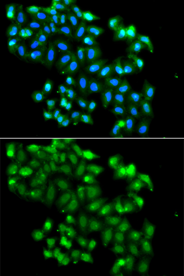 Immunohistochemistry of paraffin-embedded rat spleen using PHF11 Rabbit pAb  at dilution of 1:50 