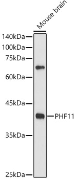 Western blot analysis of extracts of Mouse brain, using PHF11  antibody  at 1:500 dilution