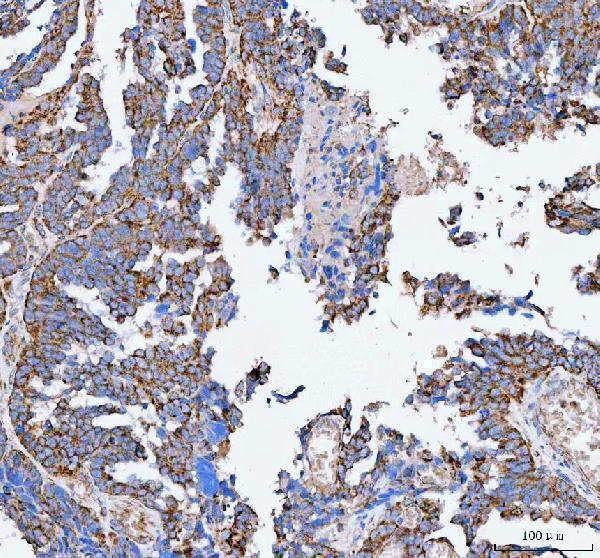  IHC analysis of PELI3 using anti-PELI3 antibody (A09622-1)