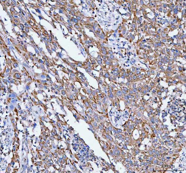  IHC analysis of PELI3 using anti-PELI3 antibody (A09622-1)