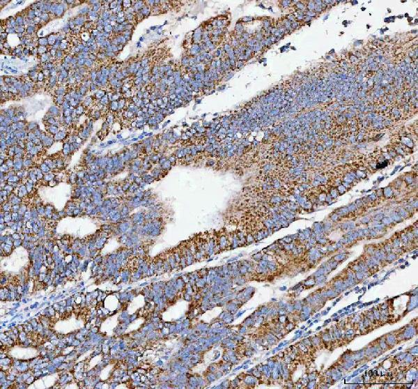 a09622 1 peli3 primary antibodies ihc testing 5
