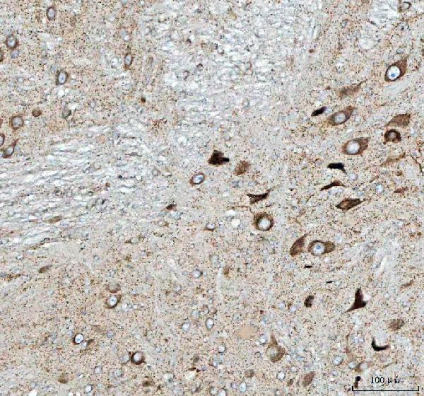 a09622 1 peli3 primary antibodies ihc testing 8