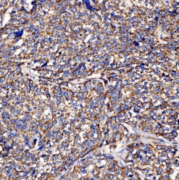 a09623 1 pmpca primary antibodies ihc testing 2