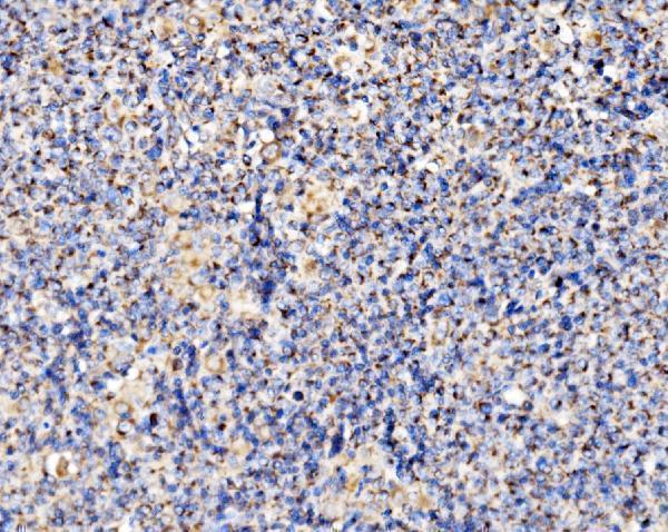 a09623 1 pmpca primary antibodies ihc testing 3