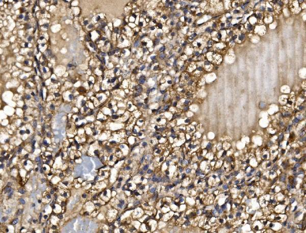 a09623 1 pmpca primary antibodies ihc testing 4