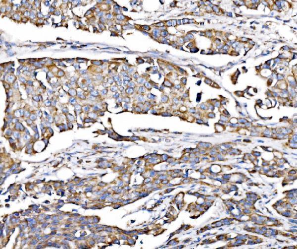 a09623 1 pmpca primary antibodies ihc testing 6