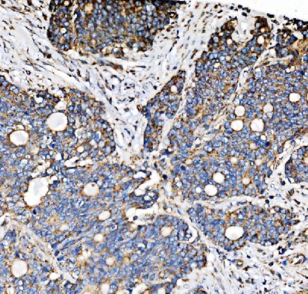 a09623 1 pmpca primary antibodies ihc testing 7