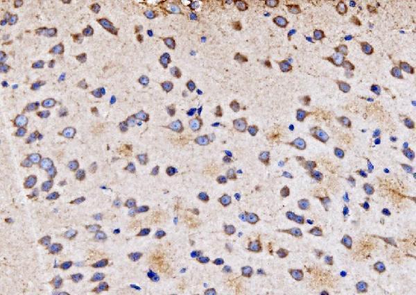 a09623 1 pmpca primary antibodies ihc testing 8