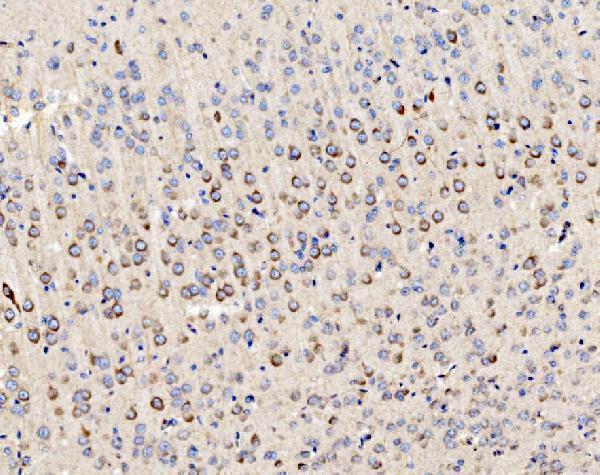 a09623 1 pmpca primary antibodies ihc testing 9