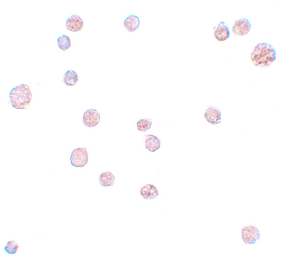 a09625 atp11a primary antibodies icc testing 2