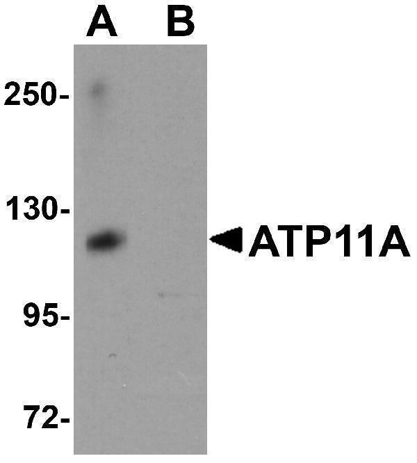 a09625 atp11a primary antibodies wb testing 1