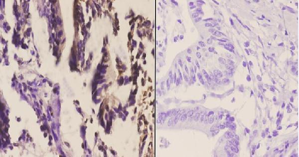 a09631 ssbp2 primary antiboties ihc testing 2