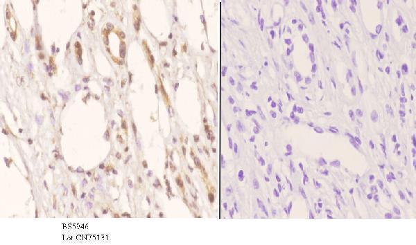 a09631 ssbp2 primary antiboties ihc testing 3