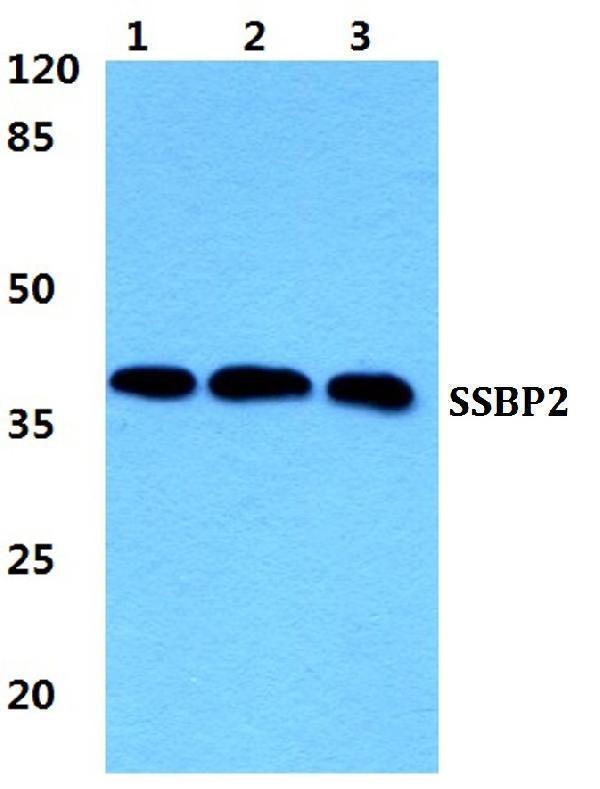 a09631 ssbp2 primary antiboties wb testing 1