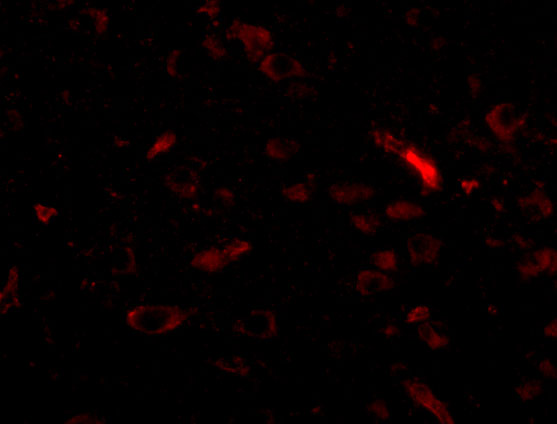 Immunofluorescence of GALNT10 in Human Brain cells with GALNT10 antibody at 20 μg/mL