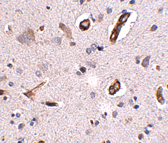 Immunohistochemistry of GALNT10 in human brain tissue with GALNT10 antibody at 2