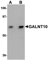 Western blot analysis of GALNT10 in SK-N-SH cell lysate with GALNT10 antibody at (A) 1 and (B) 2 μg/mL