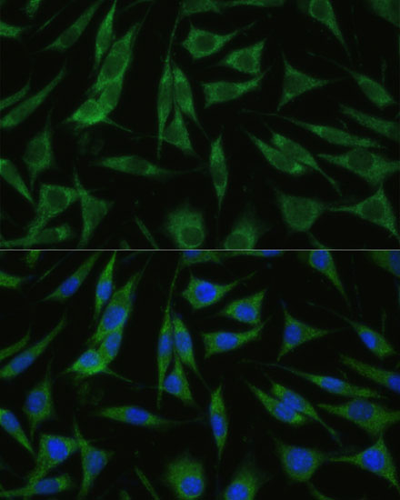 a09636 1 rhbdd1 primary antiboties if testing 2