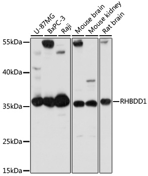 a09636 1 rhbdd1 primary antiboties wb testing 1