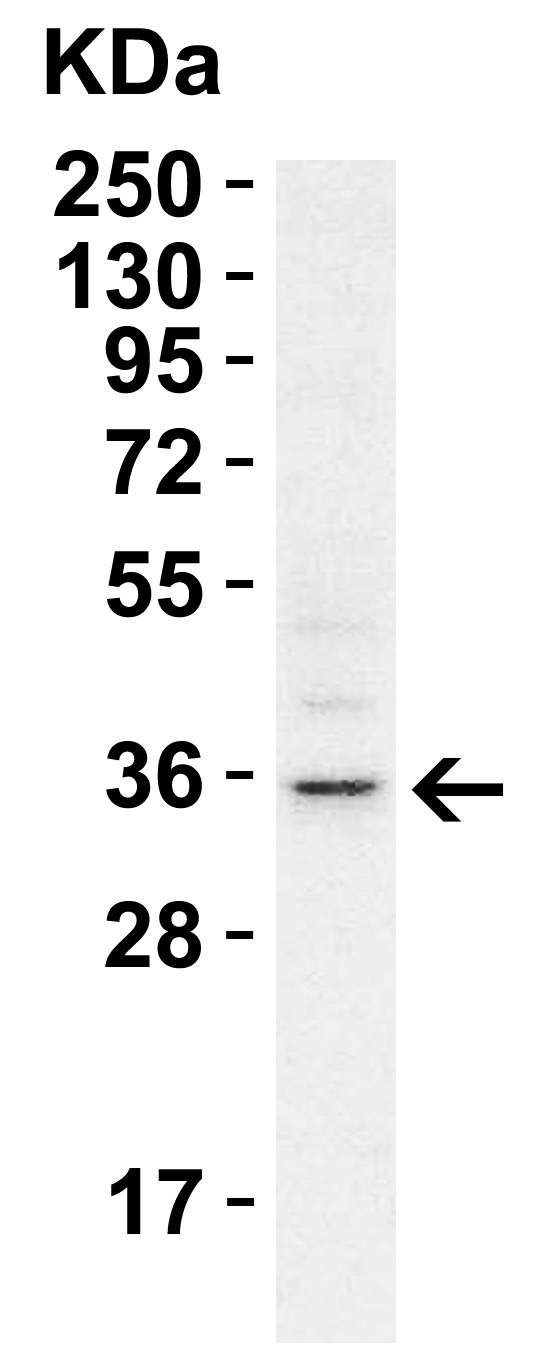  WB Validation  in A549 Cells 
Loading: 15 μg of cell lysate 
Antibodies:  RHBDD1,  A09636  1 μg/ml, 1 h incubation at RT in 5% NFDM/TBST