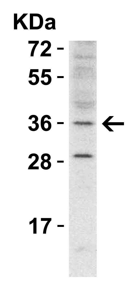  WB Validation  in Mouse Heart 
Loading: 15 μg of lysate 
Antibodies:  RHBDD1,  A09636  1 μg/ml, 1 h incubation at RT in 5% NFDM/TBST