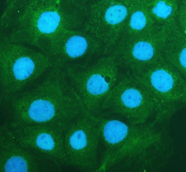 a09638 2 epb41l5 primary antibodies if testing 1