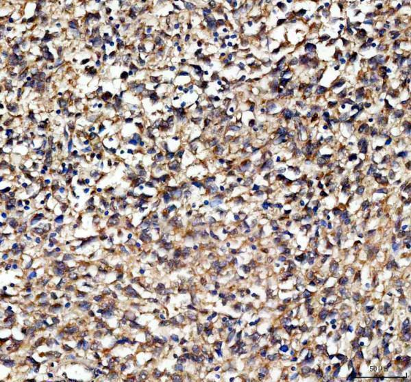 IHC analysis of EPB41L5 using anti-EPB41L5 antibody (A09638-2)