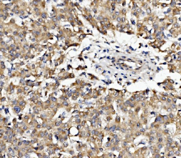 a09638 2 epb41l5 primary antibodies ihc testing 2