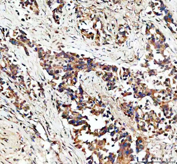 IHC analysis of EPB41L5 using anti-EPB41L5 antibody (A09638-2)