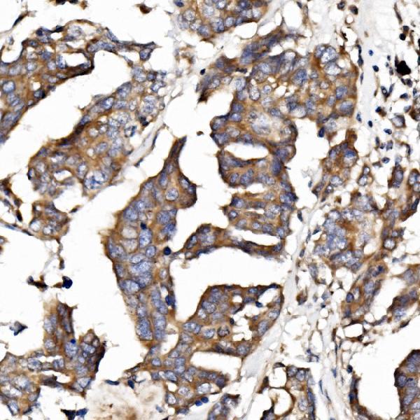 a09638 2 epb41l5 primary antibodies ihc testing 3