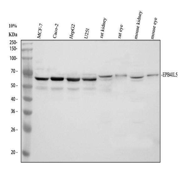 Western blot analysis of EPB41L5 using anti-EPB41L5 antibody (A09638-2)
