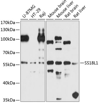 a09640 ss18l1 primary antiboties wb testing 1