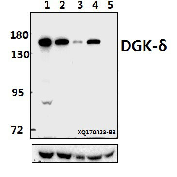 Western blot (WB) analysis of DGK-δ (S66) pAb at 1:500 dilution
Lane1:A549 whole cell lysate(40ug)
Lane2:Hela whole cell lysate(40ug)
Lane3:A2780 whole cell lysate(40ug)
Lane4:PC12 whole cell lysate(40ug)
Lane5:3T3-L1 whole cell lysate(40ug)