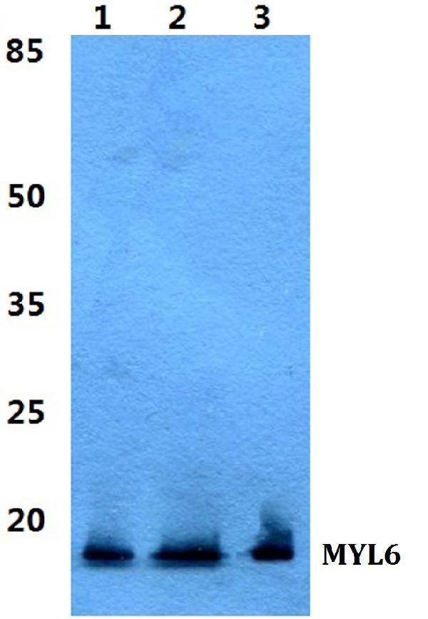 Western blot (WB) analysis of MYL6 polyclonal antibody at 1:500 dilution
Lane1:Hela cell lysate
Lane2:sp2/0 cell lysate
Lane3:H9C2 cell lysate