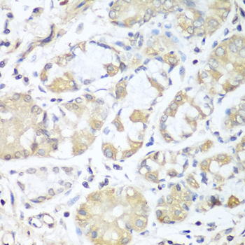a09648 rph3al primary antiboties if testing 3