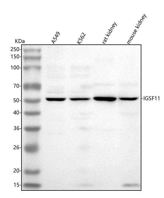  Western blot analysis of IGSF11 using anti-IGSF11 antibody (A09664-1)