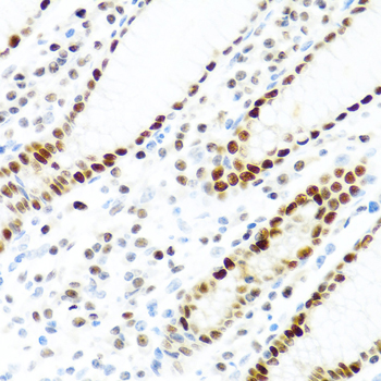 a09665 khdrbs2 primary antiboties ihc testing 4