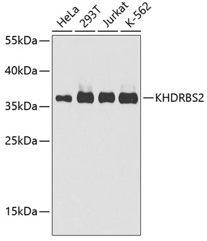 a09665 khdrbs2 primary antiboties wb testing 1
