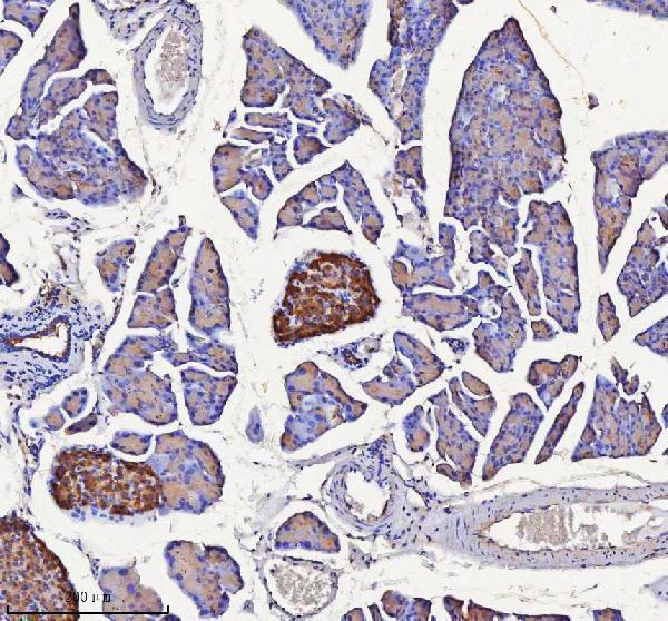 a09667 1 nptx2 primary antibodies ihc testing 2