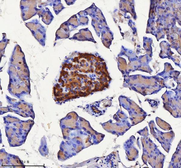 a09667 1 nptx2 primary antibodies ihc testing 3