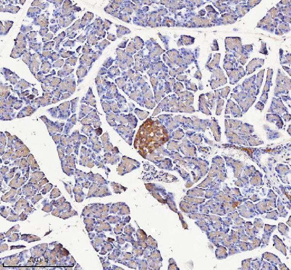 a09667 1 nptx2 primary antibodies ihc testing 4
