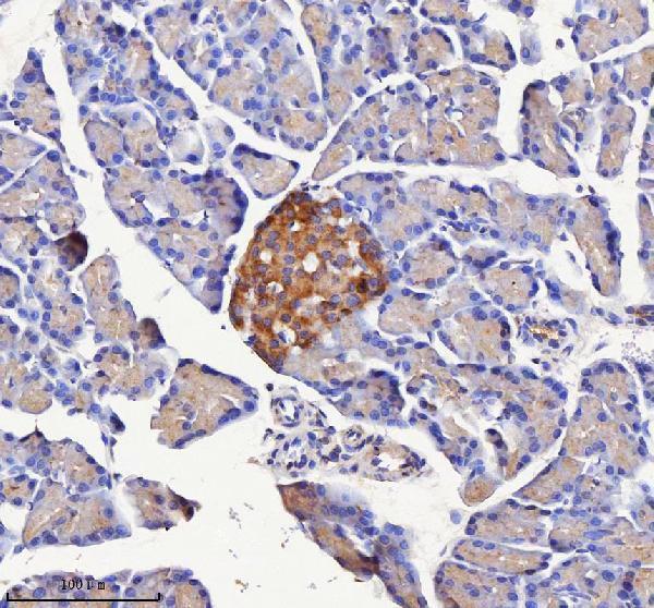 a09667 1 nptx2 primary antibodies ihc testing 5