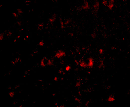 a09667 nptx2 primary antibodies if testing 4