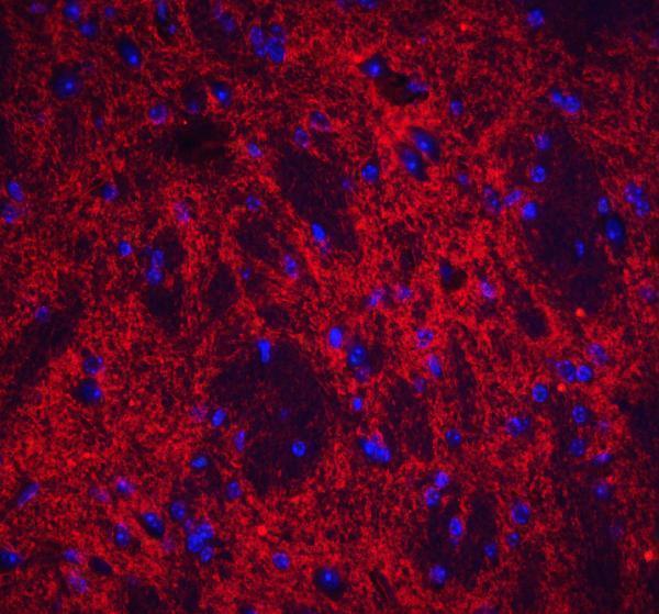 a09667 nptx2 primary antibodies if testing 6